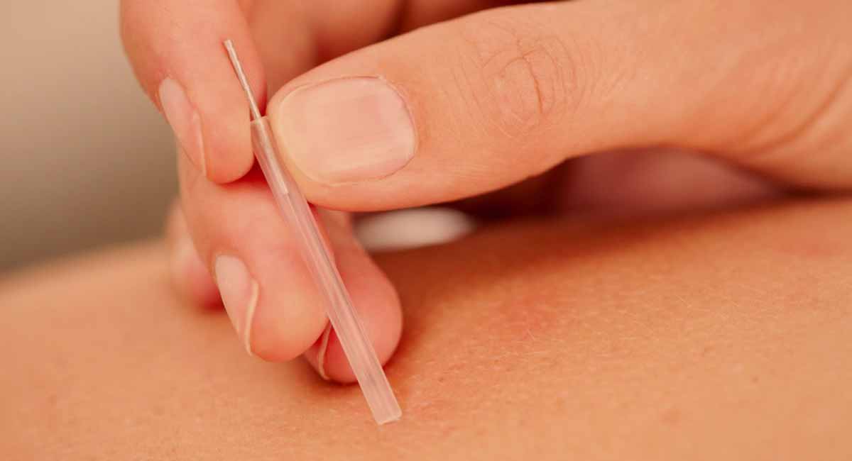 akupunktura-in-gastritis